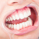 Mondspreider - No Yellow Teeth